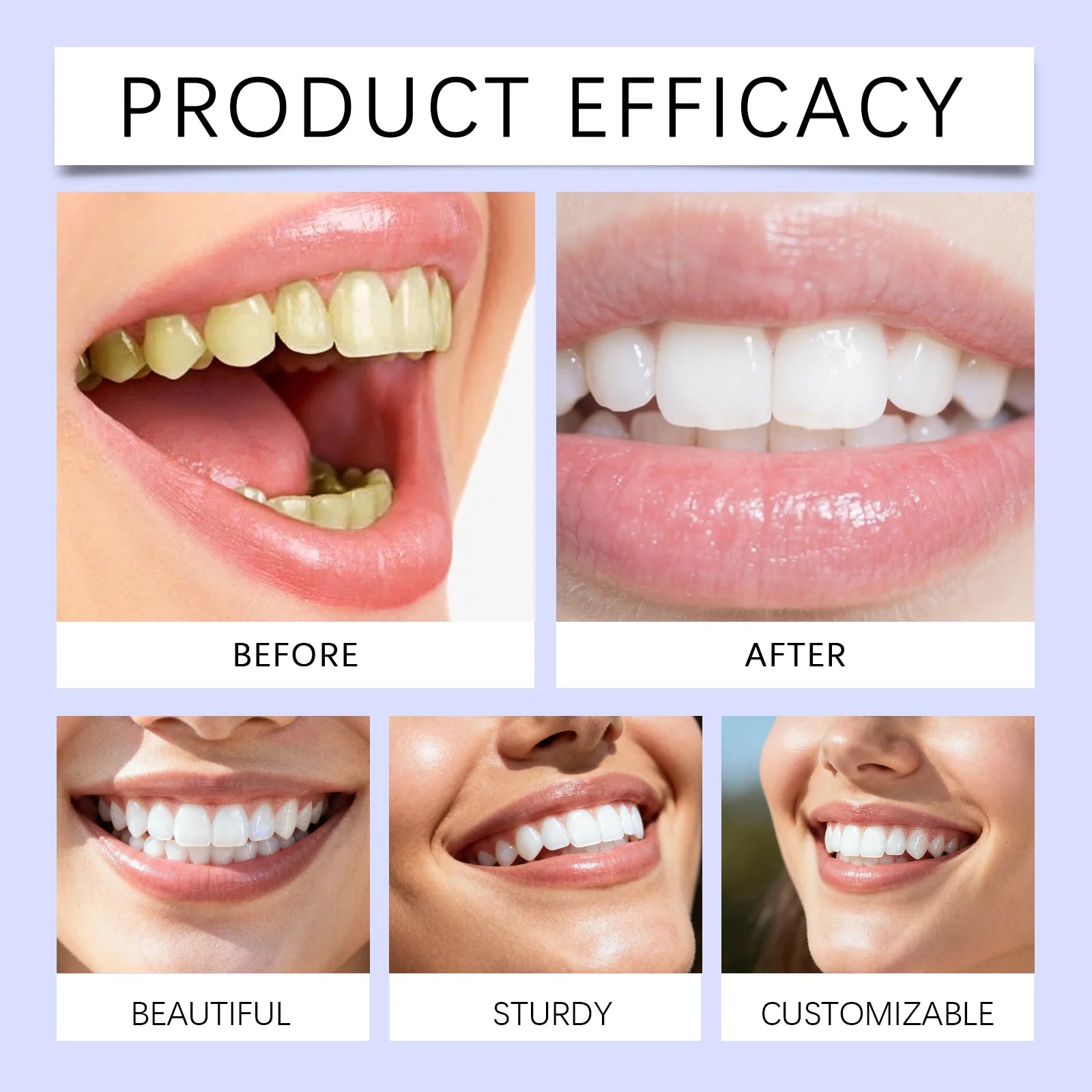 5D Teeth Whitening Strips